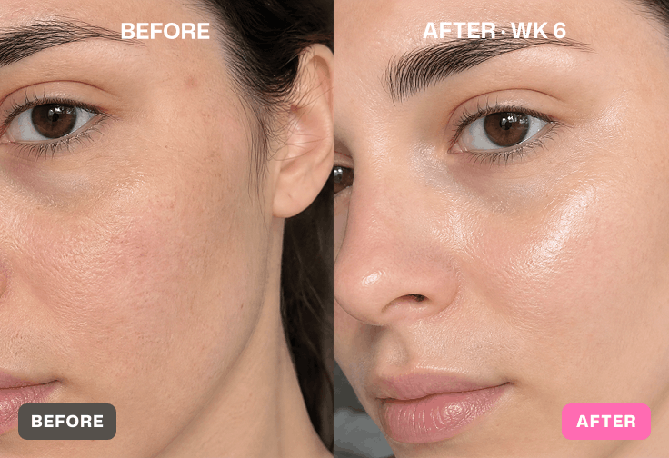 Before and after skin results
