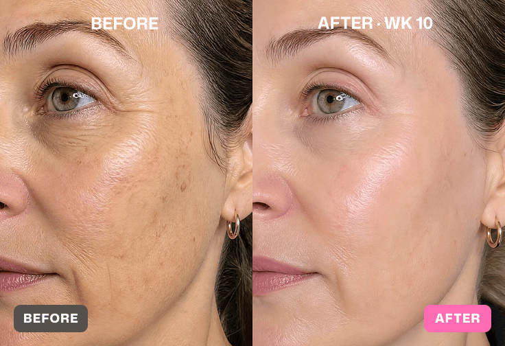 Before and after skin results