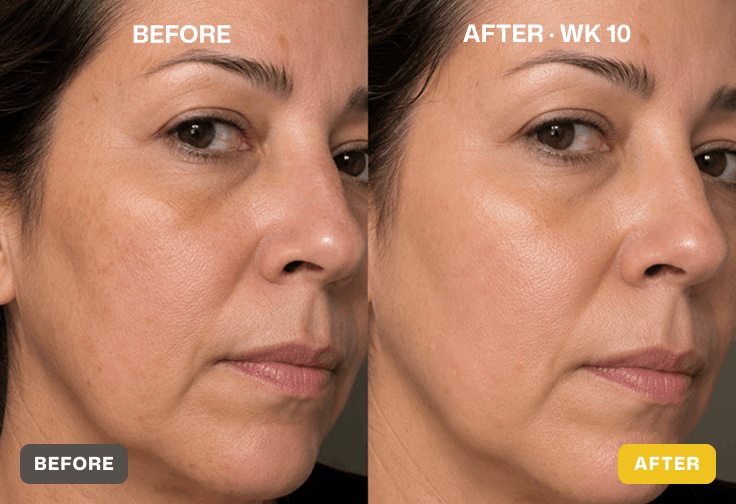 Before and after skin results