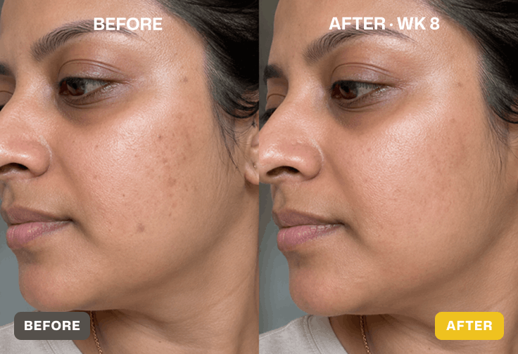 Before and after skin results