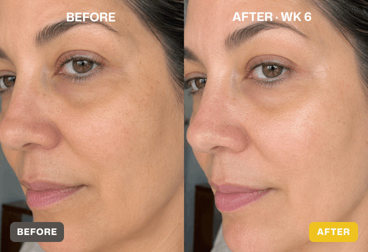 Before and after skin results